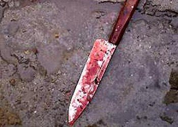Житель Львова ударил ножом киевлянина за то, что тот фотографировал под его окнами